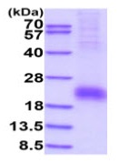 SDS-PAGE - Recombinant Human CD8 beta protein (His tag) (AB233600), expandable thumbnail