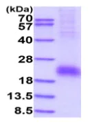 SDS-PAGE - Recombinant Human CD8 beta protein (His tag C-Terminus) (AB233600)