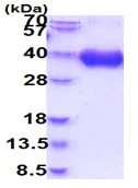 SDS-PAGE - Recombinant human CD80 protein (His tag C-Terminus) (AB227403)