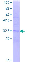SDS-PAGE - Recombinant Human CD81 protein (AB152267)