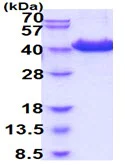 SDS-PAGE - Recombinant Human CD81 protein (Fc tag C-Terminus + His tag C-Terminus) (AB226886)