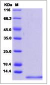 SDS-PAGE - Recombinant Human CD81 protein (His tag) (AB276616)