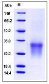 SDS-PAGE - Recombinant Human CD82 protein (His tag) (AB276475)