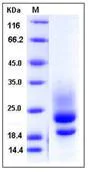 SDS-PAGE - Recombinant Human CD83 protein (His tag) (AB276430)