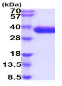 SDS-PAGE - Recombinant Human CD84 protein (His tag) (AB219484)