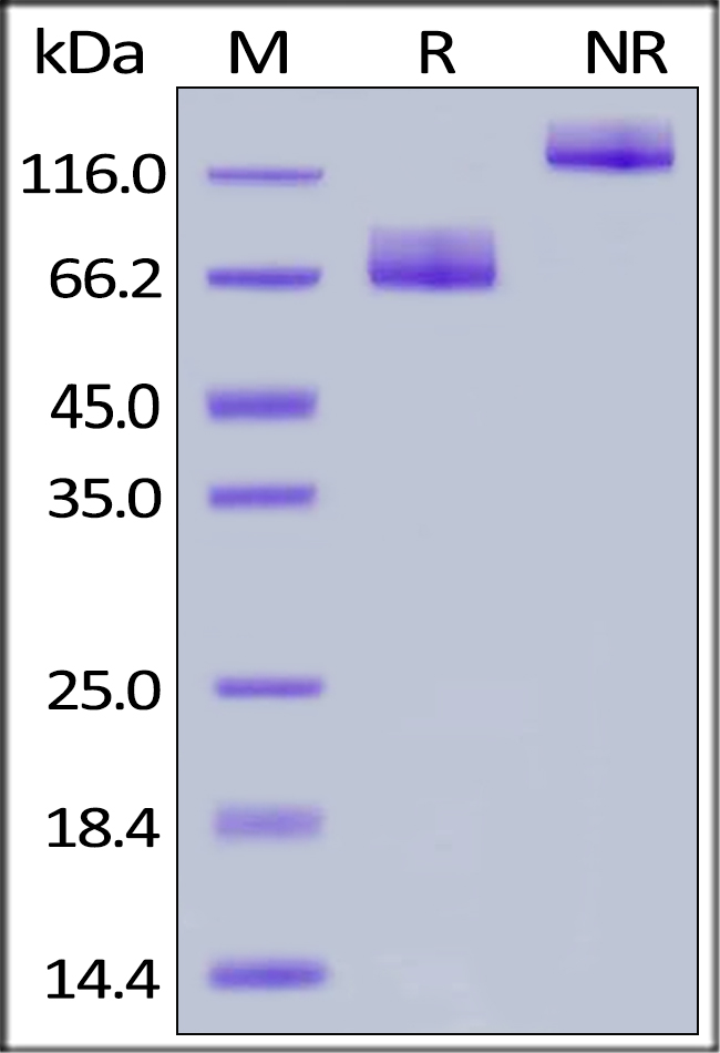 SDS-PAGE - Recombinant human CD86 protein (Fc Chimera) (AB167720), expandable thumbnail