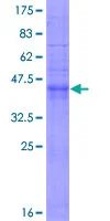 SDS-PAGE - Recombinant Human CD9 protein (GST tag N-Terminus) (AB152262)