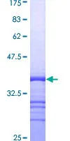 SDS-PAGE - Recombinant Human CD9 protein (GST tag N-Terminus) (AB152263)