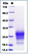 SDS-PAGE - Recombinant Human CD90 / Thy1 protein (His tag) (AB276727), expandable thumbnail