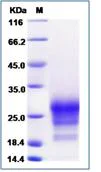 SDS-PAGE - Recombinant Human CD90 / Thy1 protein (His tag) (AB276727)