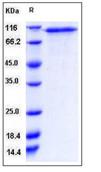 SDS-PAGE - Recombinant Human CD93 protein (His tag) (AB276485), expandable thumbnail
