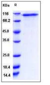 SDS-PAGE - Recombinant Human CD93 protein (His tag) (AB276485)