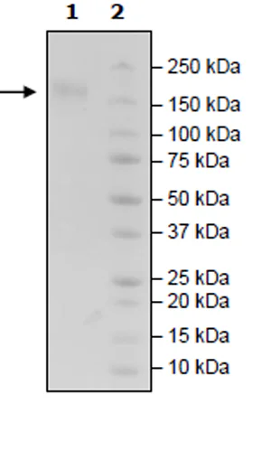 SDS-PAGE - Recombinant Human CD96 protein (Avi tag C-Terminus + Fc tag C-Terminus) (AB271454)