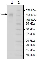 SDS-PAGE - Recombinant Human CD96 protein (Biotin) (Avi tag C-Terminus + Fc tag C-Terminus) (AB271455)