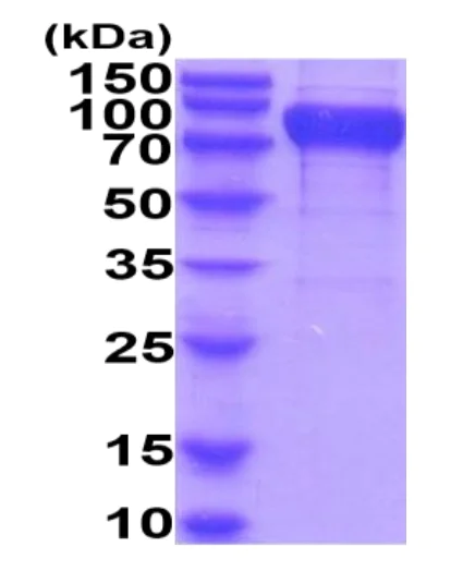 SDS-PAGE - Recombinant Human CD96 protein (His tag) (AB222978)