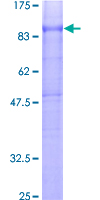 SDS-PAGE - Recombinant Human CD97 protein (AB131865)