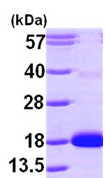 SDS-PAGE - Recombinant human CDA protein (His tag N-Terminus) (AB99441)