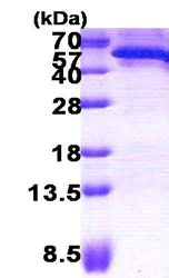 SDS-PAGE - Recombinant Human CDC123 protein (His tag N-Terminus) (AB156329)