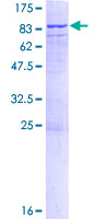SDS-PAGE - Recombinant Human CDC2L6 protein (AB161531)