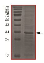 SDS-PAGE - Recombinant Human Cdc34 protein (AB151828), expandable thumbnail