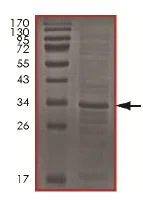 SDS-PAGE - Recombinant Human Cdc34 protein (AB151828)
