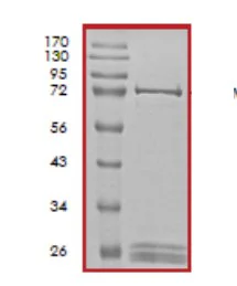 SDS-PAGE - Recombinant human CDC42 binding protein kinase alpha (GST tag N-Terminus) (AB59979)