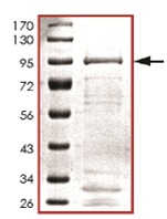 Recombinant Human CDC7 protein