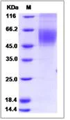 SDS-PAGE - Recombinant Human CDCP1 protein (His tag) (AB276523)
