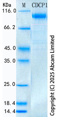 SDS-PAGE - Recombinant Human CDCP1 Protein Standard (His tag) (AB323829), expandable thumbnail
