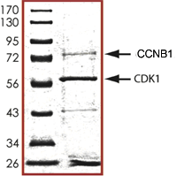 SDS-PAGE - Recombinant human CDK1 + CCNB1 protein (Tagged) (AB104618), expandable thumbnail