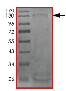 SDS-PAGE - Recombinant Human CDK12 protein (AB204102)