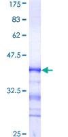 SDS-PAGE - Recombinant Human CDK13 protein (AB160115)
