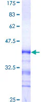 SDS-PAGE - Recombinant Human CDK13 protein (GST tag N-Terminus) (AB160115)