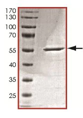 SDS-PAGE - Recombinant Human CDK2 protein (AB126917)