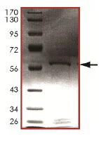 SDS-PAGE - Recombinant Human CDK2 protein (GST tag N-Terminus) (AB125664)