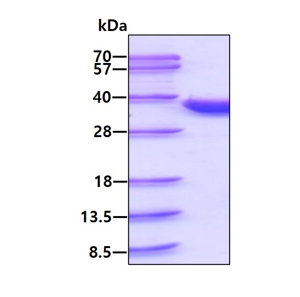 SDS-PAGE - Recombinant Human CDK2 protein (His tag C-Terminus) (AB111646)