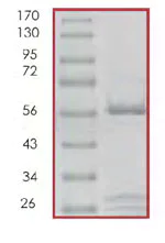 SDS-PAGE - Recombinant human CDK4 + CCND3 protein (AB85646)