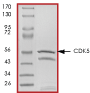 SDS-PAGE - Recombinant human CDK5 + p25 protein (AB60761), expandable thumbnail