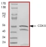 SDS-PAGE - Recombinant human CDK5 + p25 protein (GST tag N-Terminus) (AB60761)