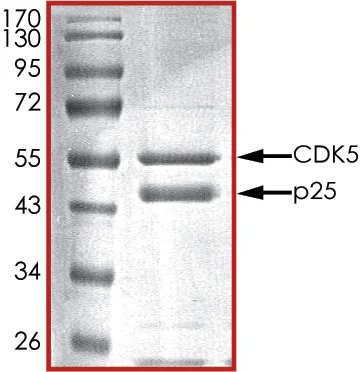 SDS-PAGE - Recombinant human CDK5 + p25 protein (GST tag N-Terminus) (AB60761)