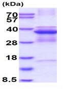 SDS-PAGE - Recombinant Human Cdk5 protein (denatured) (His tag N-Terminus) (AB137142)