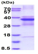 SDS-PAGE - Recombinant Human Cdk5 protein (denatured) (His tag N-Terminus) (AB137142)