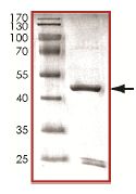 SDS-PAGE - Recombinant Human CDK5R1(p25) protein. (AB125653), expandable thumbnail