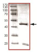 SDS-PAGE - Recombinant Human CDK5R1(p25) protein. (AB125653)