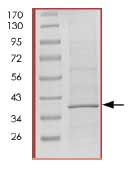 SDS-PAGE - Recombinant Human Cdk6 protein (His tag N-Terminus) (AB84717)