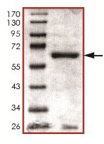 SDS-PAGE - Recombinant Human Cdk7 protein (GST tag N-Terminus) (AB126920)