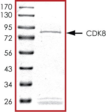 SDS-PAGE - Recombinant Human Cdk8 protein (Tagged) (AB268399)