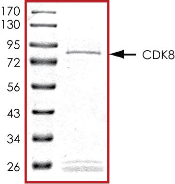 SDS-PAGE - Recombinant Human Cdk8 protein (Tagged) (AB268399)