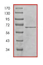 SDS-PAGE - Recombinant Human Cdk9 protein (AB85603), expandable thumbnail