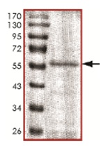 SDS-PAGE - Recombinant Human CDKL1 protein (AB167944)